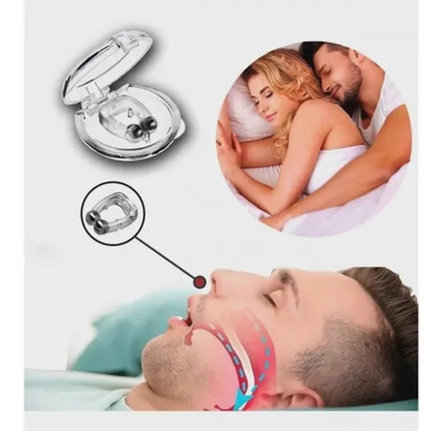 RespiraEasy - Advanced Anti-Snoring Device