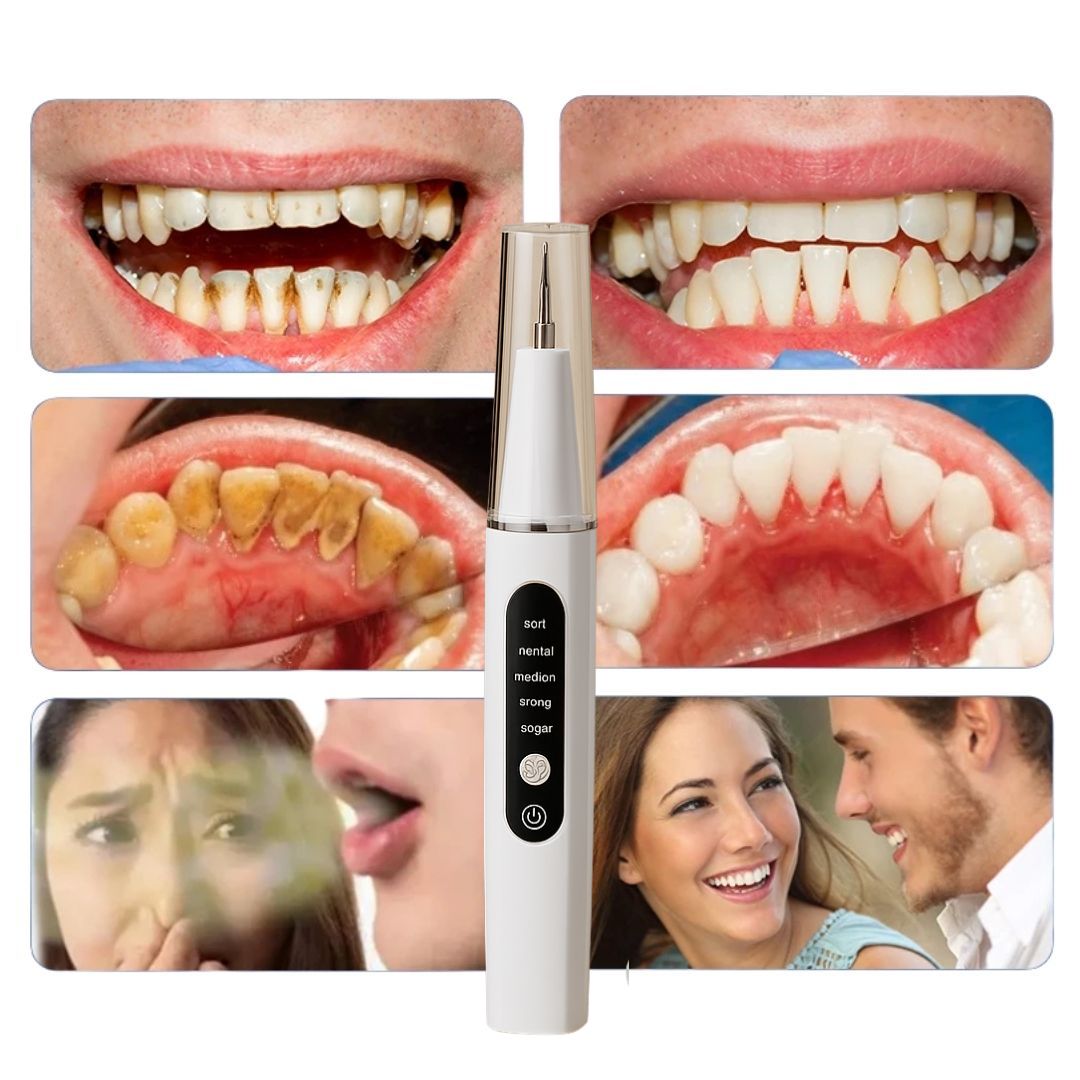 ProClean Advanced Tartar Removal Kit