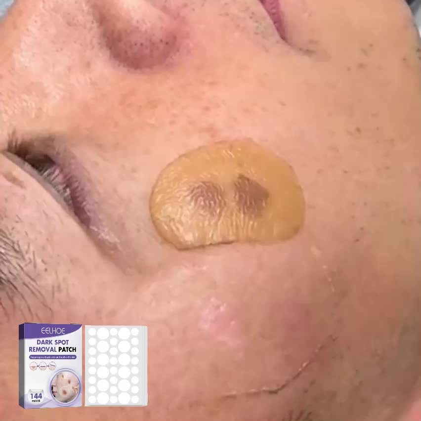 EELHOE Dark Spot Removal Patch™