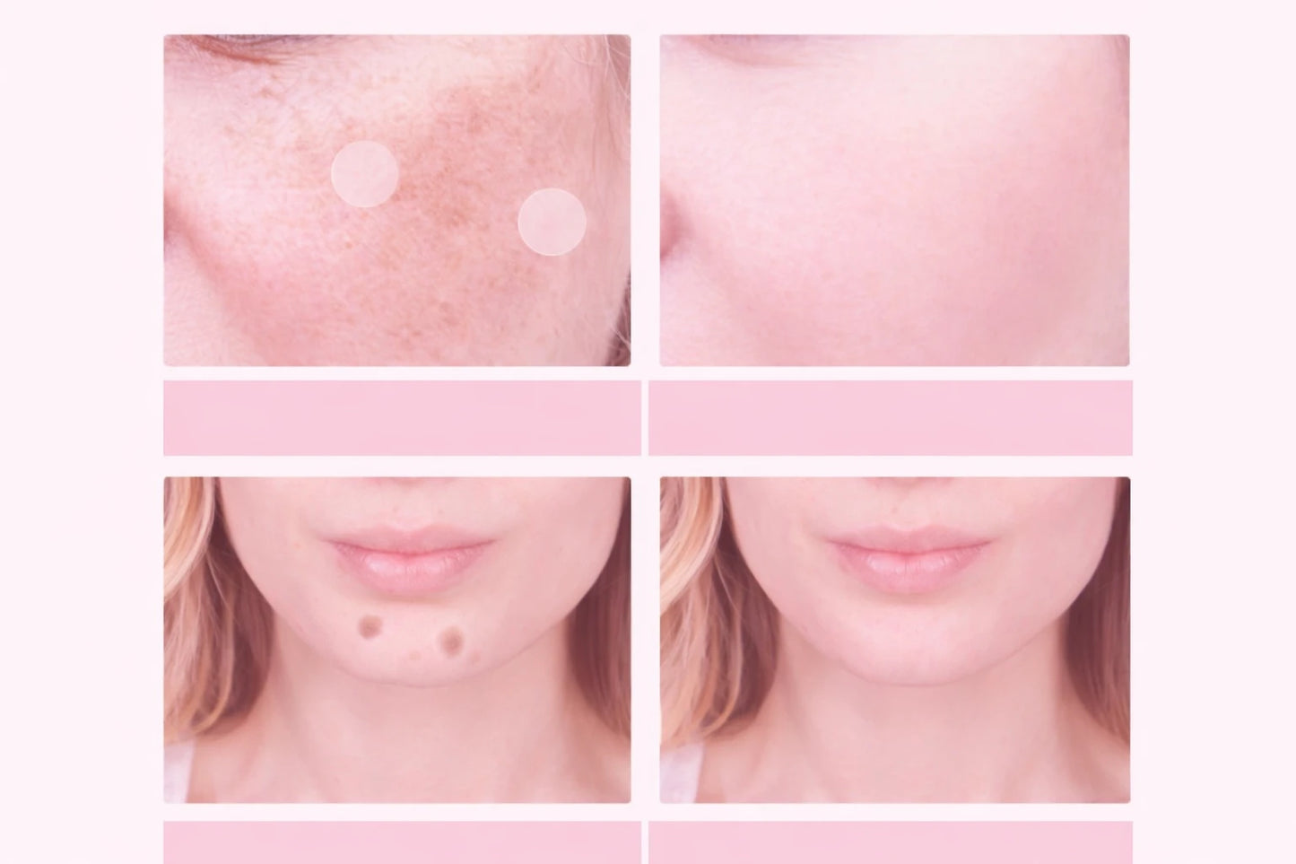 EELHOE Dark Spot Removal Patch™