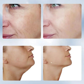 LumiLift™ – Visible Lifting & Firming for Face, Chin & Neck + FREE EyeCare Pen™